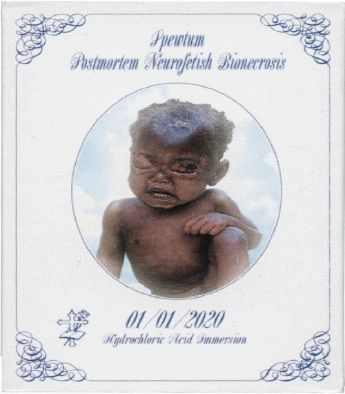 Spewtum : Hydrochloric Acid Immersion